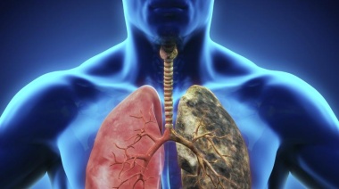 Un nuevo tratamiento aumenta la supervivencia en pacientes con cáncer de pulmón
