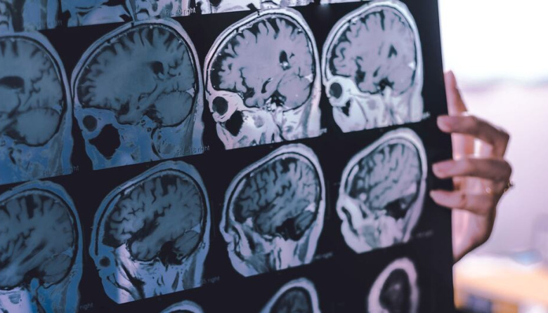 Hasta el 45% del riesgo de demencia puede prevenirse o retrasarse, según la OMS