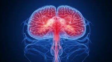 Avance en tumores cerebrales: una nueva herramienta de inteligencia artificial los diagnostica durante la cirugía
