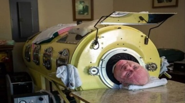 Murió Paul Alexander, el hombre que vivió más de 70 años en un pulmón de acero