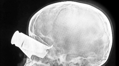 Sudán bajo drones: Los médicos revelan la anatomía de una guerra permitida