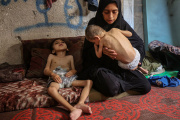 La ONU declara oficialmente la hambruna en Gaza por “la obstrucción sistemática de Israel”